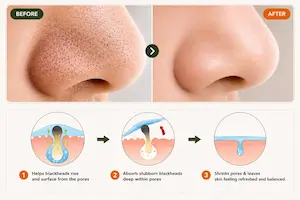 Before and after pore-care results
